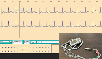 HOLTER Rythmiques